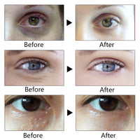 Anti-Wrinkle Eye Cream  Remove Dark Circles Lightening Eye Cream for Eyes Care Anti-aging Eye Creams