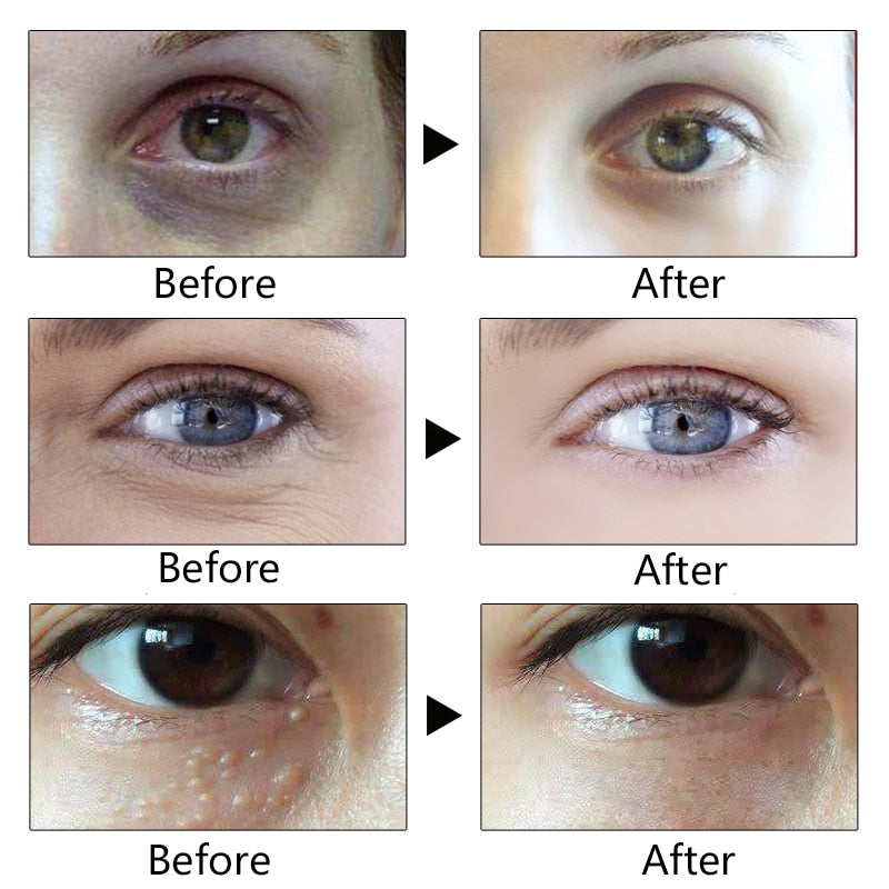 Anti-Wrinkle Eye Cream  Remove Dark Circles Lightening Eye Cream for Eyes Care Anti-aging Eye Creams