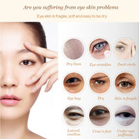 Anti-Wrinkle Eye Cream  Remove Dark Circles Lightening Eye Cream for Eyes Care Anti-aging Eye Creams