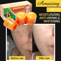 Dark Spot Corrector Cream, Skin Bleaching Cream, Various Spots Removal, Whitening Face Cream, With Organic Papaya, Anti-freckles
