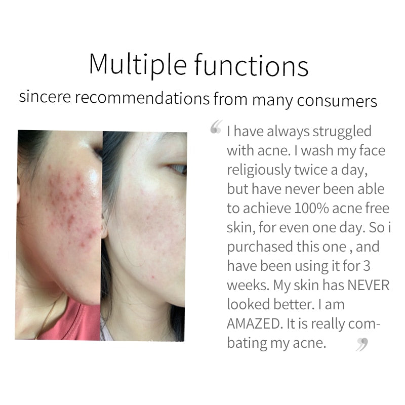Turmeric Facial Cleanser Remove Blackhead Lighten Dark Spots Whitening Moisturizing Oil Control Shrinking Pores Foam Face Wash