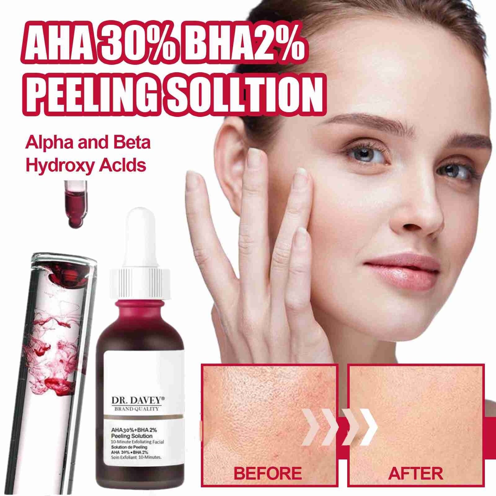 AHA 30% + BHA 2% Peeling Solution