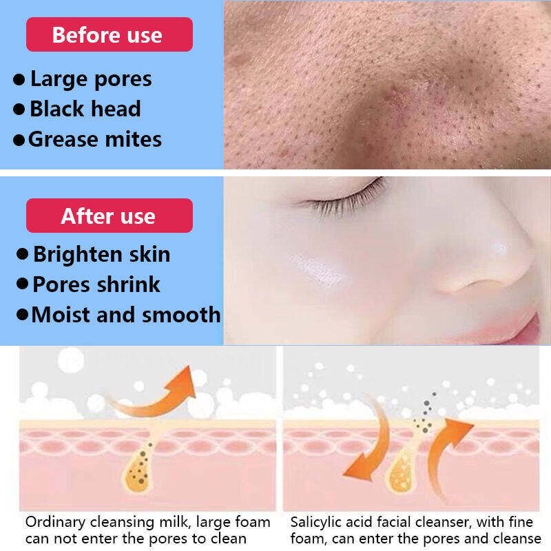 Salicylic Acid 2 Mask Clean And Mild No Stimulation Improve Roughness And Shrink Pores Exfoliated Closed Mouth Acne 50ml