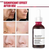 AHA 30% + BHA 2% Peeling Solution