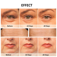 RF Face Lift Devices Electric Skin Rejuvenation Radio Frequency Facial Massager Light Therapy Anti Aging Wrinkle Skin Tightening