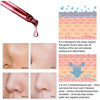 AHA 30% + BHA 2% Peeling Solution