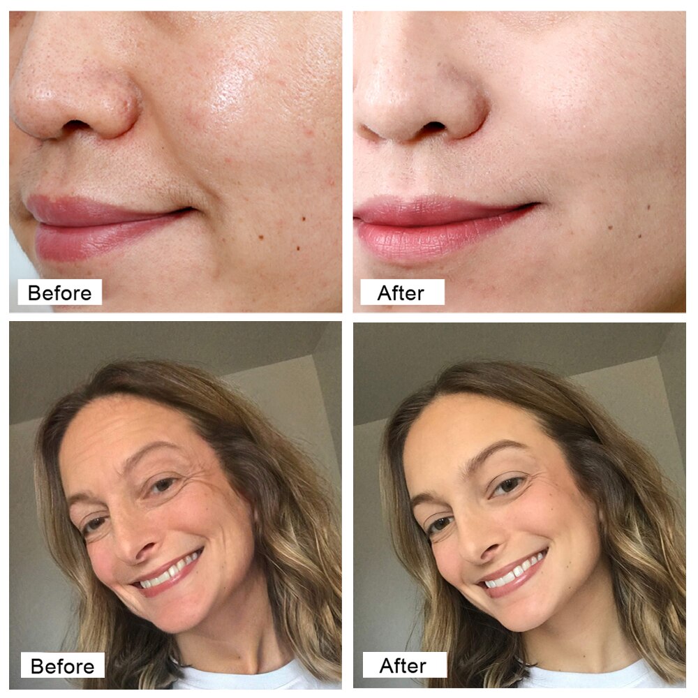5 Seconds Instant Wrinkle Remover Face Cream Nourishing Anti Aging Skin Care Facial Lifting Whitening Beauty Health
