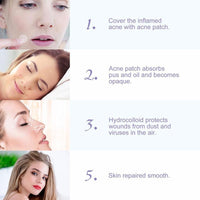 Blemish Patches For Face Breathable Pimple Patches 108 Invisible Hydrocolloid Bandages Absorbing Patches Zit Stickers