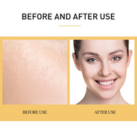 Face Sheet Mask Acne Serum Moisturizing Retinol Anti Wrinkle Remove Facial Sleeping Mask Shrink Pores Skin Care Products