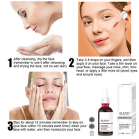 AHA 30% + BHA 2% Peeling Solution