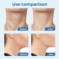 Electric Neck Beauty Massager EMS Color Light Neck Beauty Equipment Face and Neck Massage Neck Wrinkles USB Charging