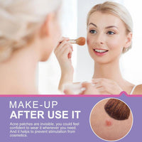 Blemish Patches For Face Breathable Pimple Patches 108 Invisible Hydrocolloid Bandages Absorbing Patches Zit Stickers