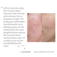 Turmeric Facial Cleanser Remove Blackhead Lighten Dark Spots Whitening Moisturizing Oil Control Shrinking Pores Foam Face Wash