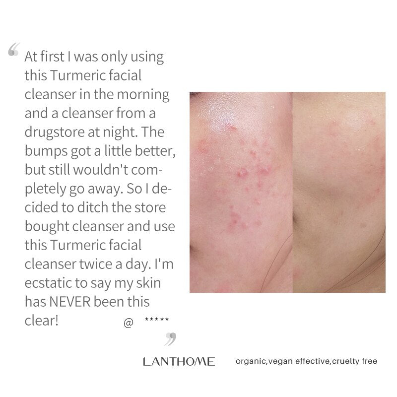 Turmeric Facial Cleanser Remove Blackhead Lighten Dark Spots Whitening Moisturizing Oil Control Shrinking Pores Foam Face Wash