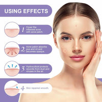 Blemish Patches For Face Breathable Pimple Patches 108 Invisible Hydrocolloid Bandages Absorbing Patches Zit Stickers