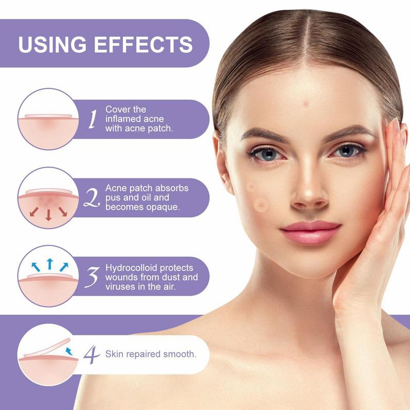 Blemish Patches For Face Breathable Pimple Patches 108 Invisible Hydrocolloid Bandages Absorbing Patches Zit Stickers