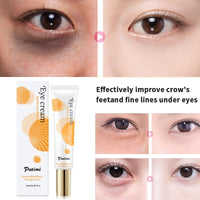 Anti-Aging Eye Cream Remove Dark Circles Puffiness And Bags Lighten Fine Lines Whitening Moisturizing Eye Creams Eye Care
