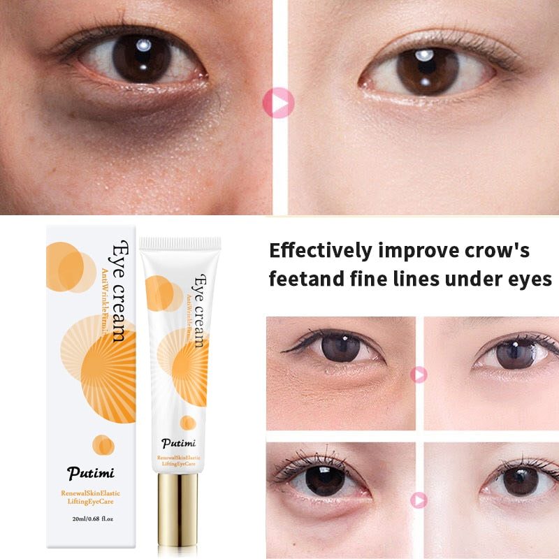 Anti-Aging Eye Cream Remove Dark Circles Puffiness And Bags Lighten Fine Lines Whitening Moisturizing Eye Creams Eye Care