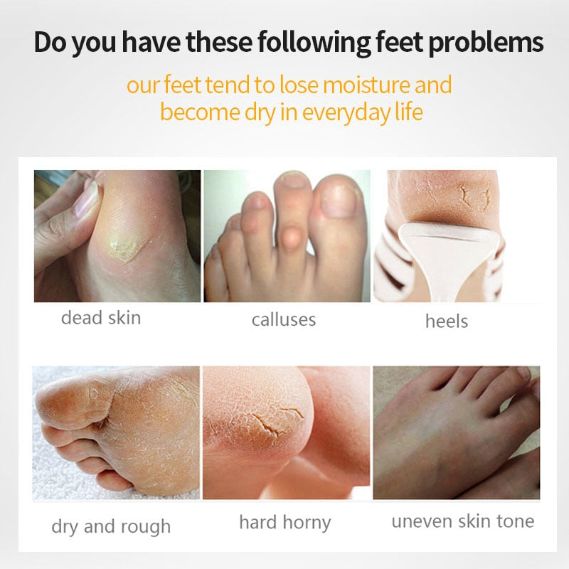 10 Pairs Exfoliating Feet Mask Foot Care Pedicure Socks Foot Masks for Heels Peeling Dead Skin Remover Feet SPA Skin Care
