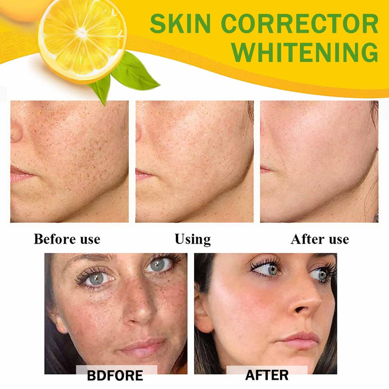 Dark Spot Corrector Cream, Skin Bleaching Cream, Various Spots Removal, Whitening Face Cream, With Organic Papaya, Anti-freckles