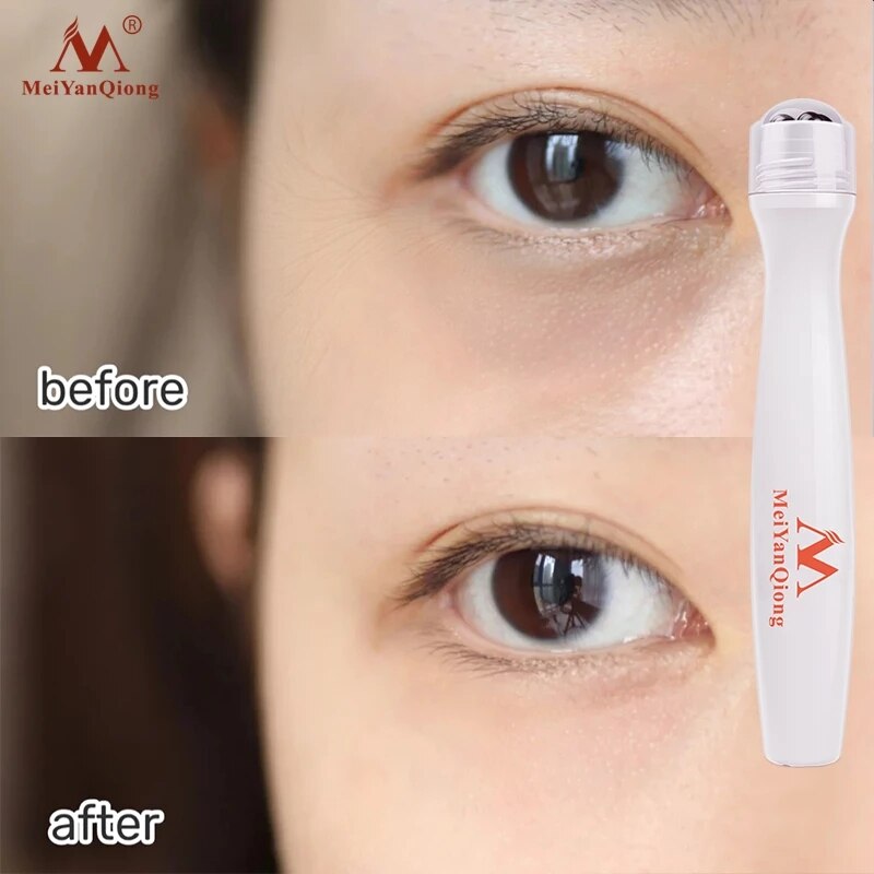 15ML MeiYanQiong Eye Cream Essence To Remove Wrinkles Anti-puffiness Fade Dark Circles Anti-aging Face Serum Moisturizing